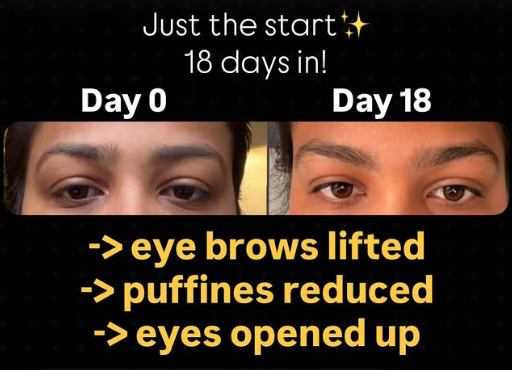 Before and after result 1 of 5