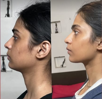 A woman looking confidently at the camera