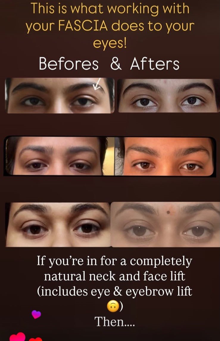 Before and after result 3 of 5