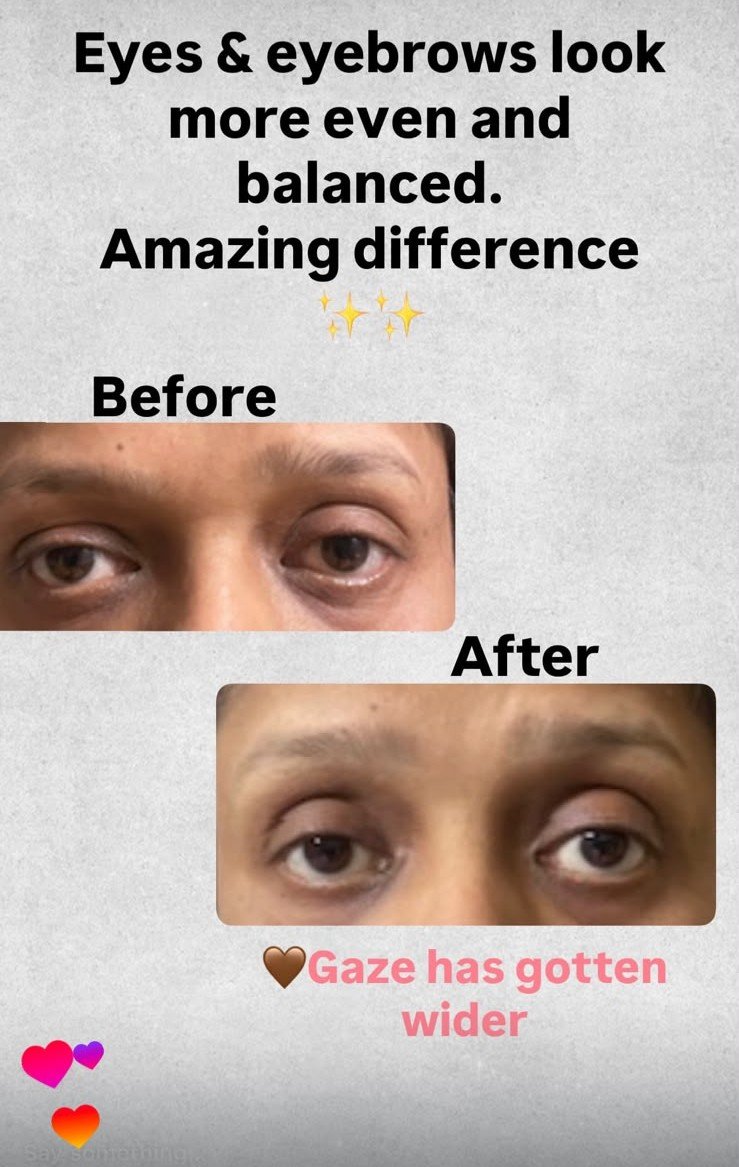 Before and after result 4 of 5