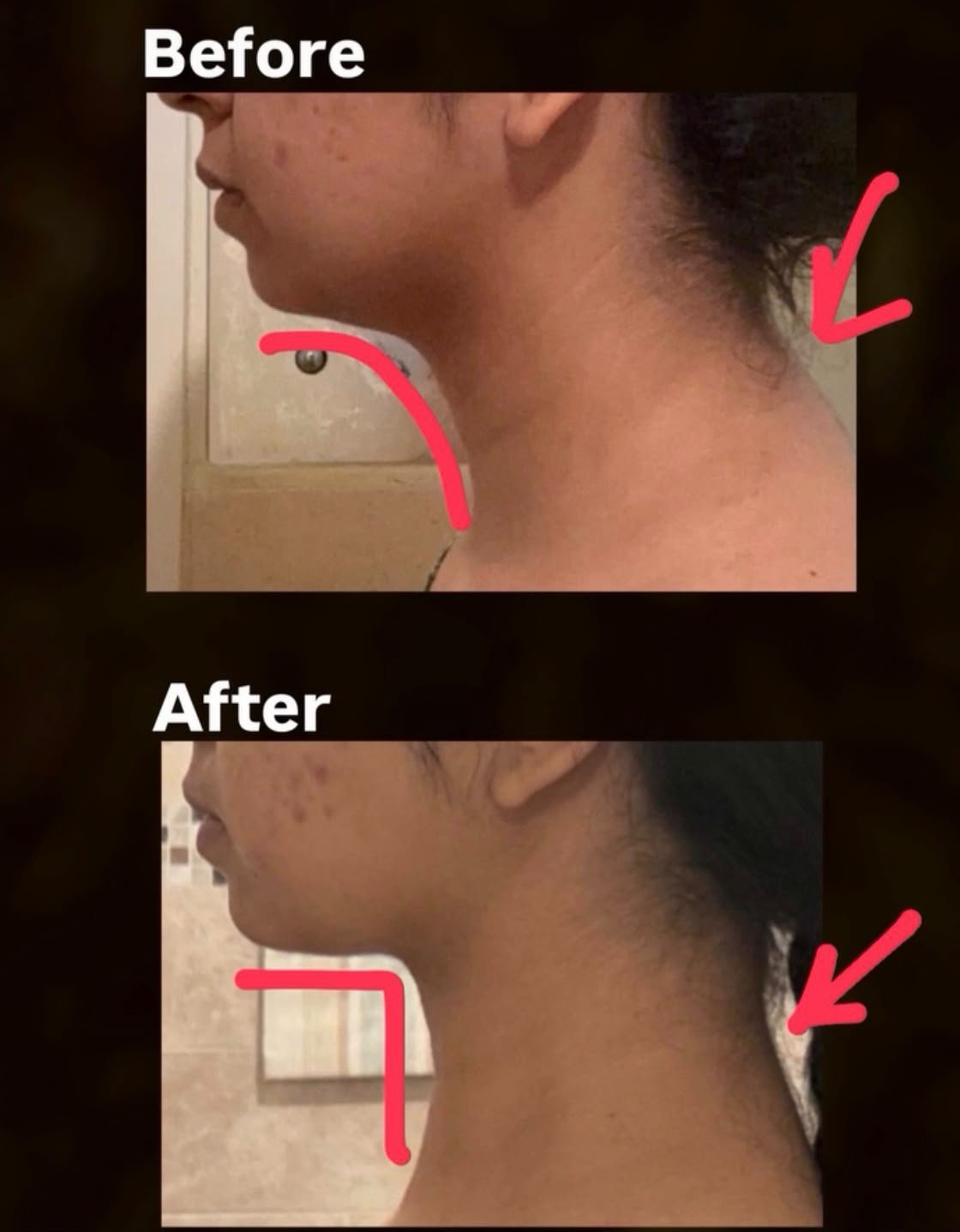 Before and after result 2 of 5