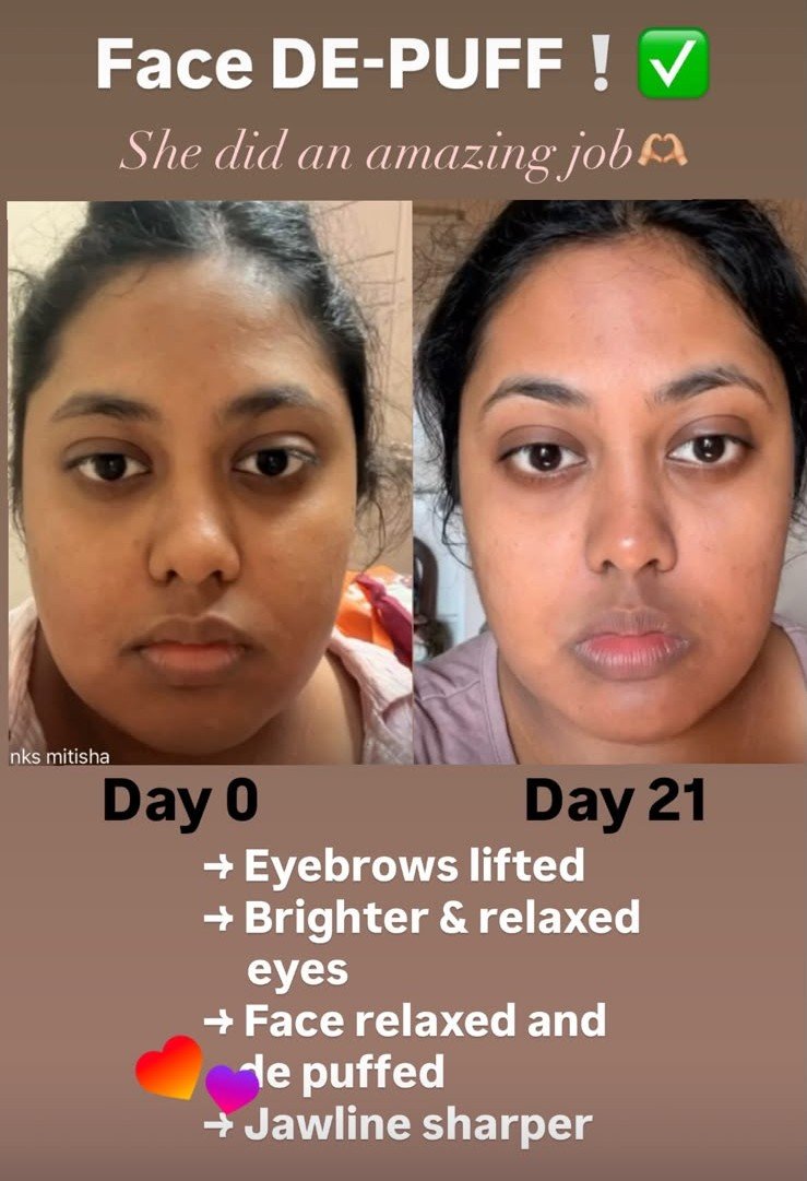 Before and after result 5 of 5